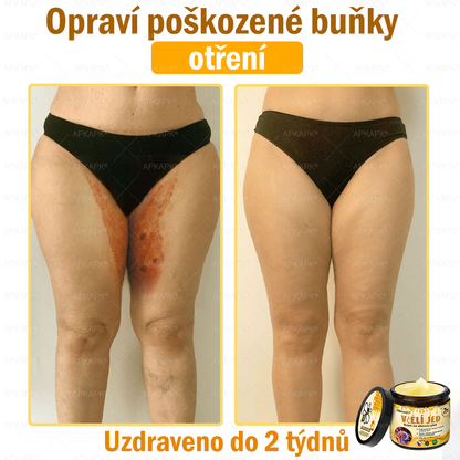 Dermatologicky a klinicky testováno👩‍⚕️APKAPK®Bee Venom Krém na obnovení pleti🐝 pomáhá při léčbě kožních problémů, jako jsou: vrásky, jizvy, pigmentové skvrny, strie, akné, psoriáza, ekzém, kožní změny, podráždění, záněty a další kožní problémy.